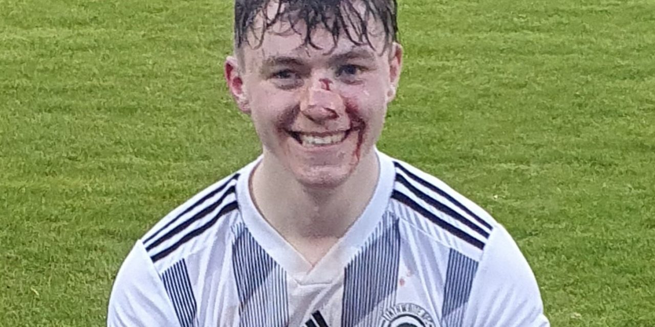 Bloodied and battered Nat nose where the goal is